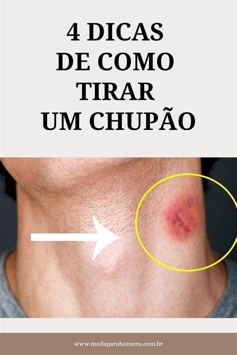 como tirsr chupao|COMO TIRAR MARCA DE CHUPÃO